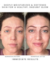 CALYPSO Antioxidant Glow Facial Oil: Sea Vitamin C + CoQ10
